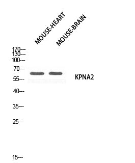 Karyopherin α2 Rabbit Polyclonal Antibody