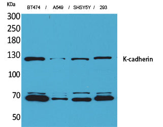 K-cadherin Rabbit Polyclonal Antibody