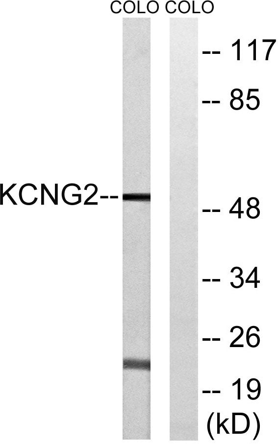 KCNG2 Rabbit Polyclonal Antibody