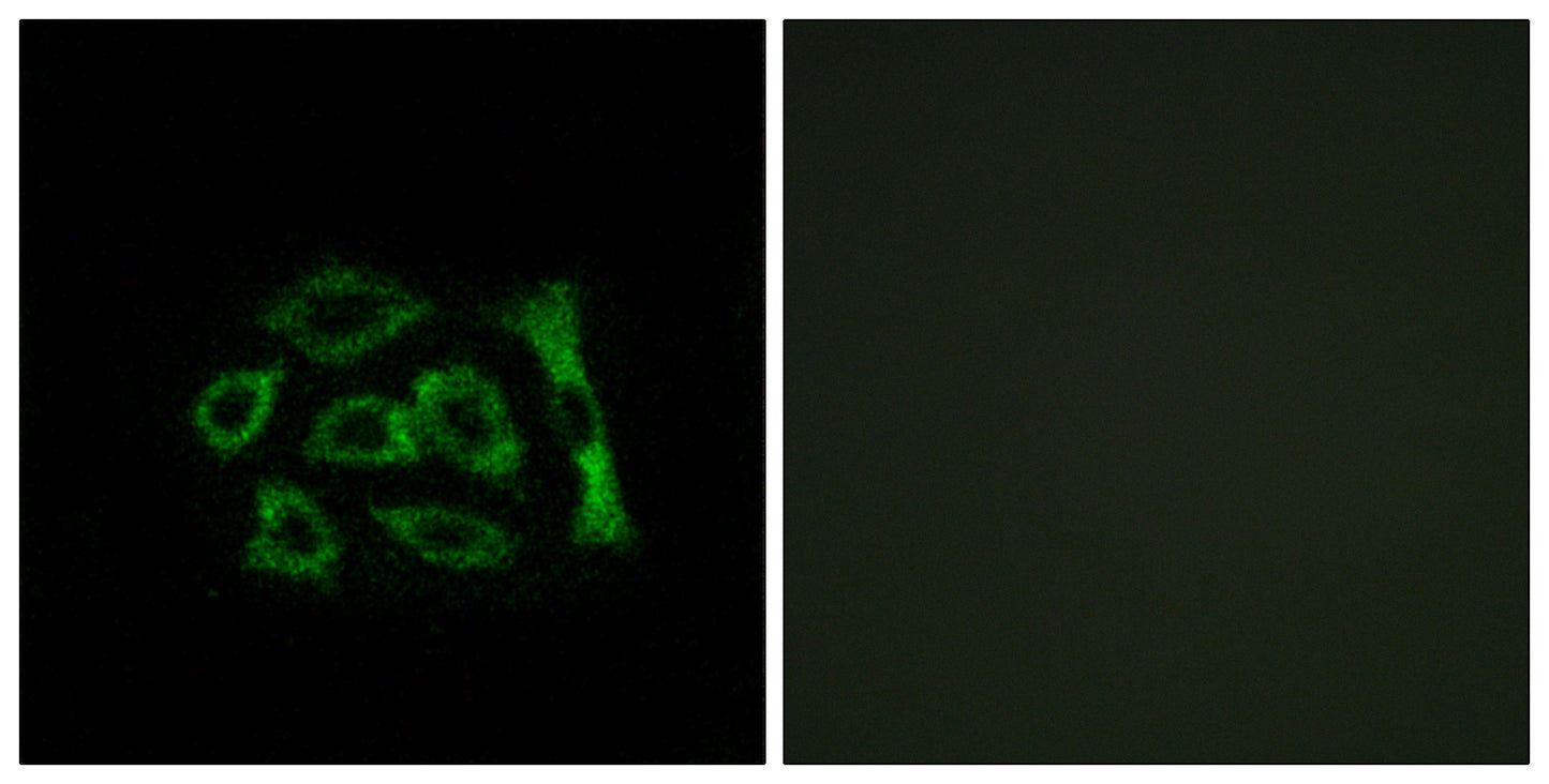 KDEL Receptor 2 Rabbit Polyclonal Antibody