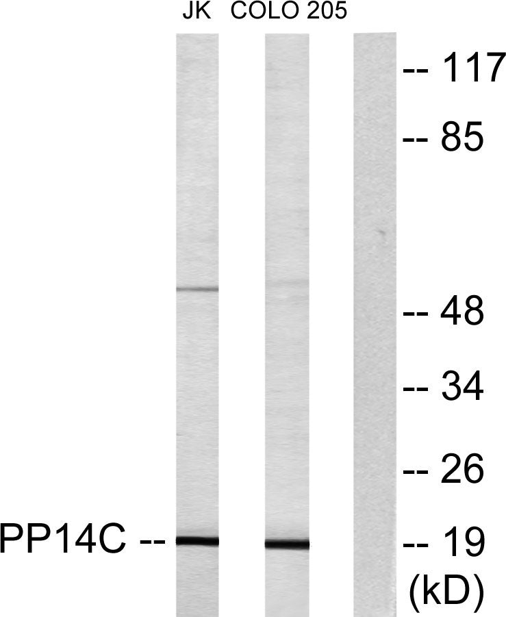 KEPI Rabbit Polyclonal Antibody