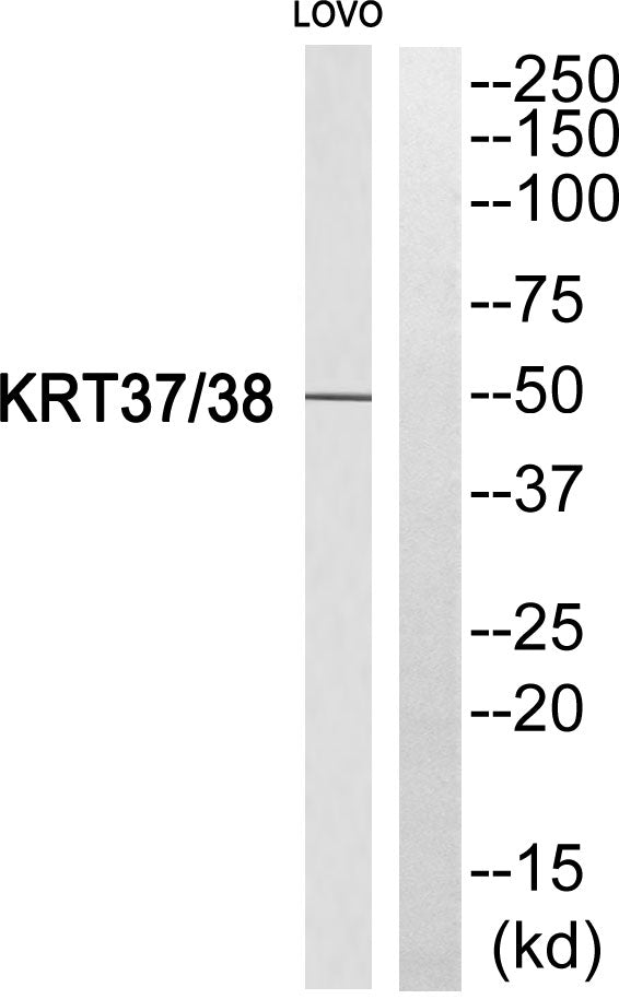 Keratin 37/38 Rabbit Polyclonal Antibody
