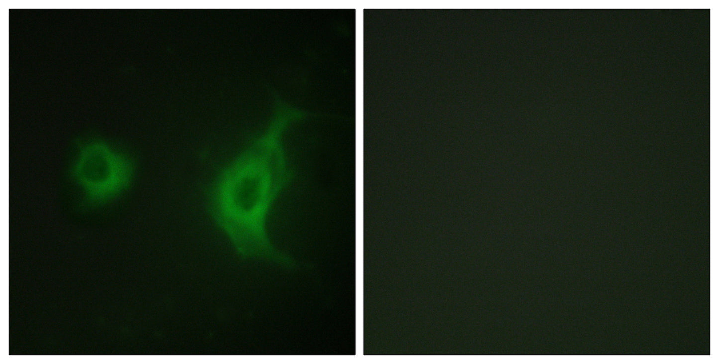 KIF20A Rabbit Polyclonal Antibody