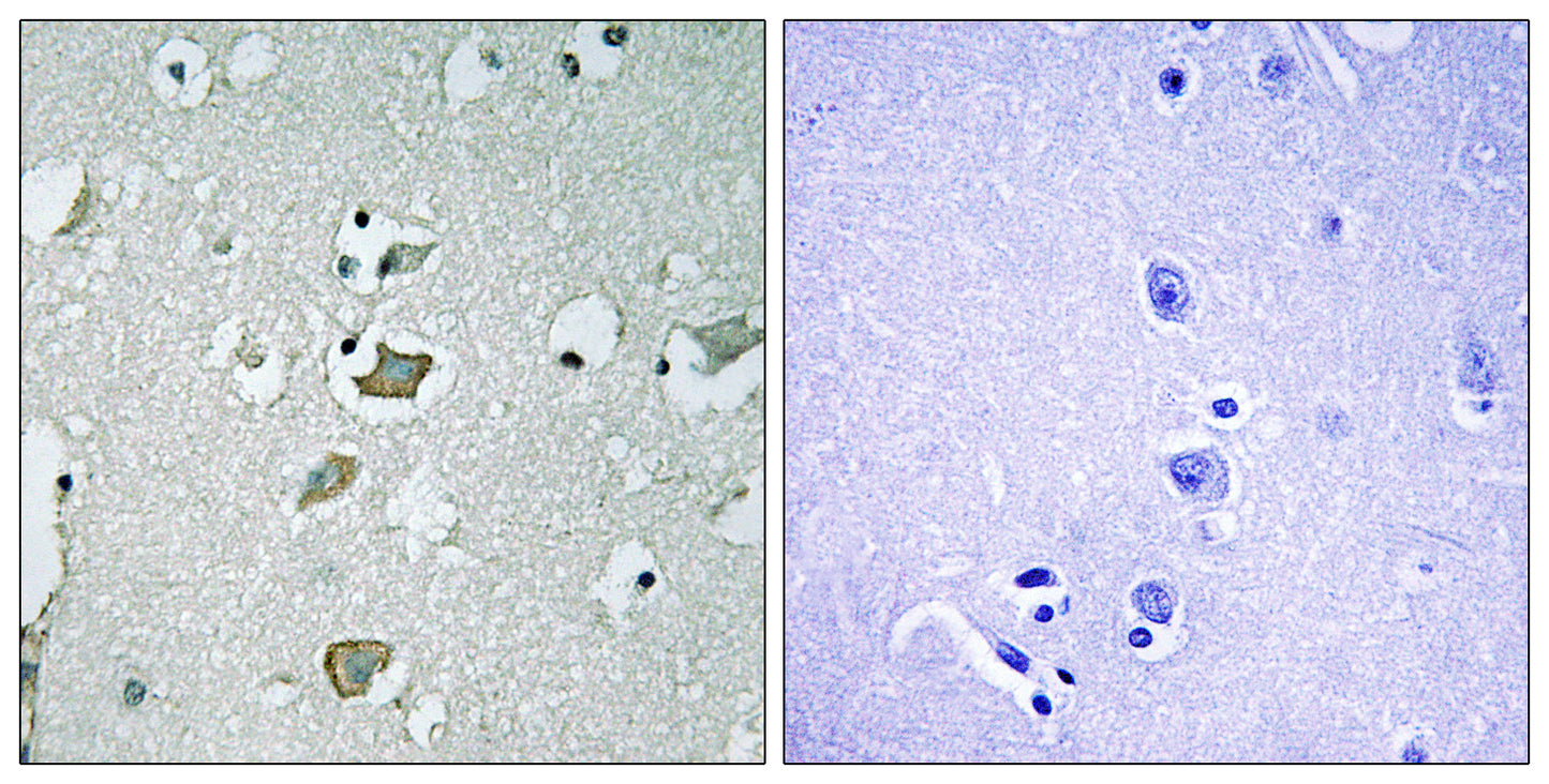 KIR2.1 Rabbit Polyclonal Antibody
