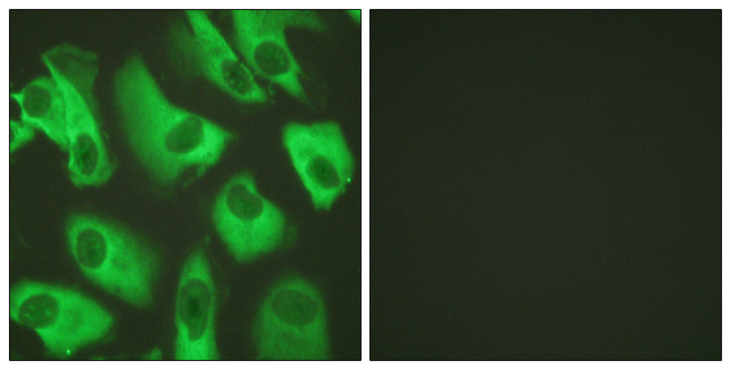 KIR5.1 Rabbit Polyclonal Antibody