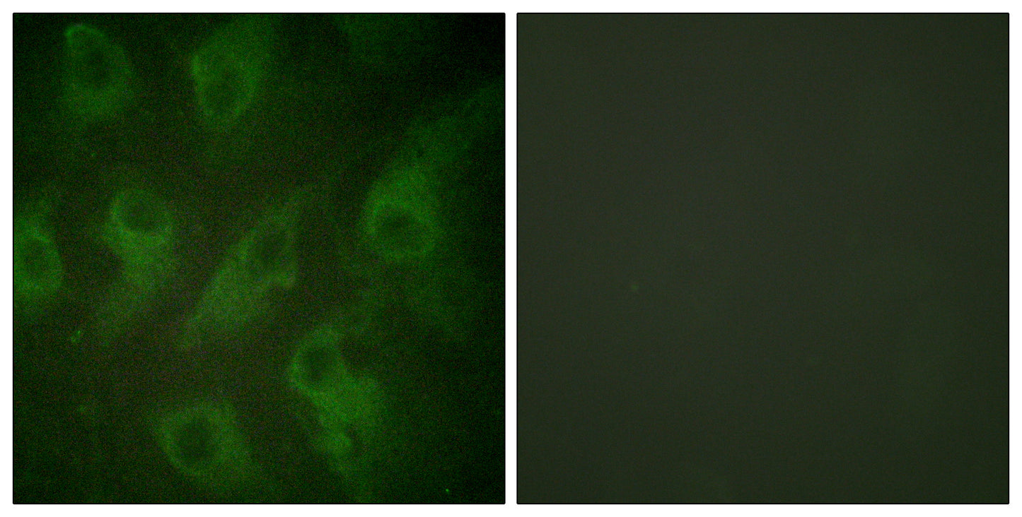 KIR6.2 Rabbit Polyclonal Antibody