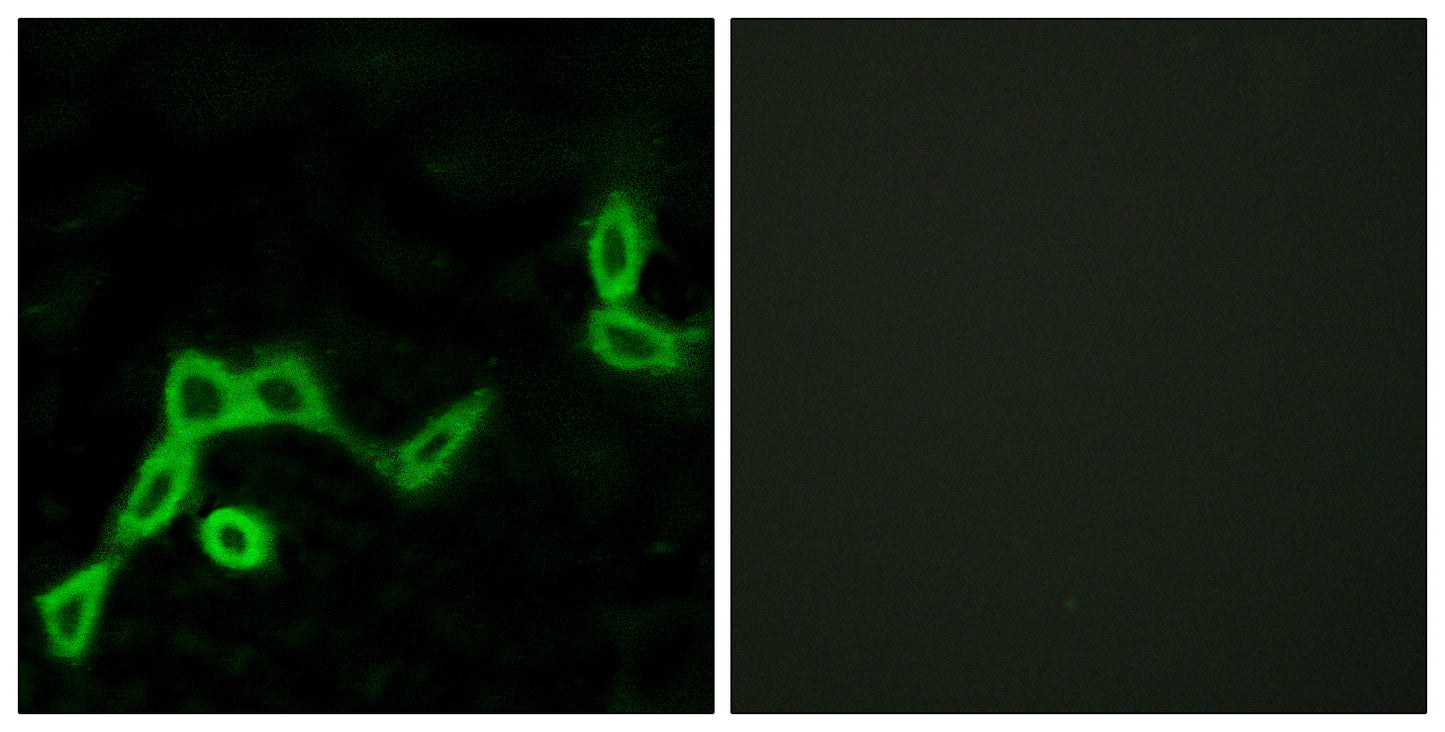 KiSS-1R Rabbit Polyclonal Antibody