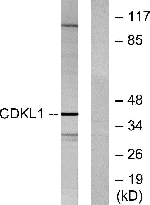 KKIALRE Rabbit Polyclonal Antibody