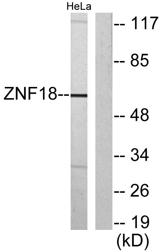 KOX11 Rabbit Polyclonal Antibody