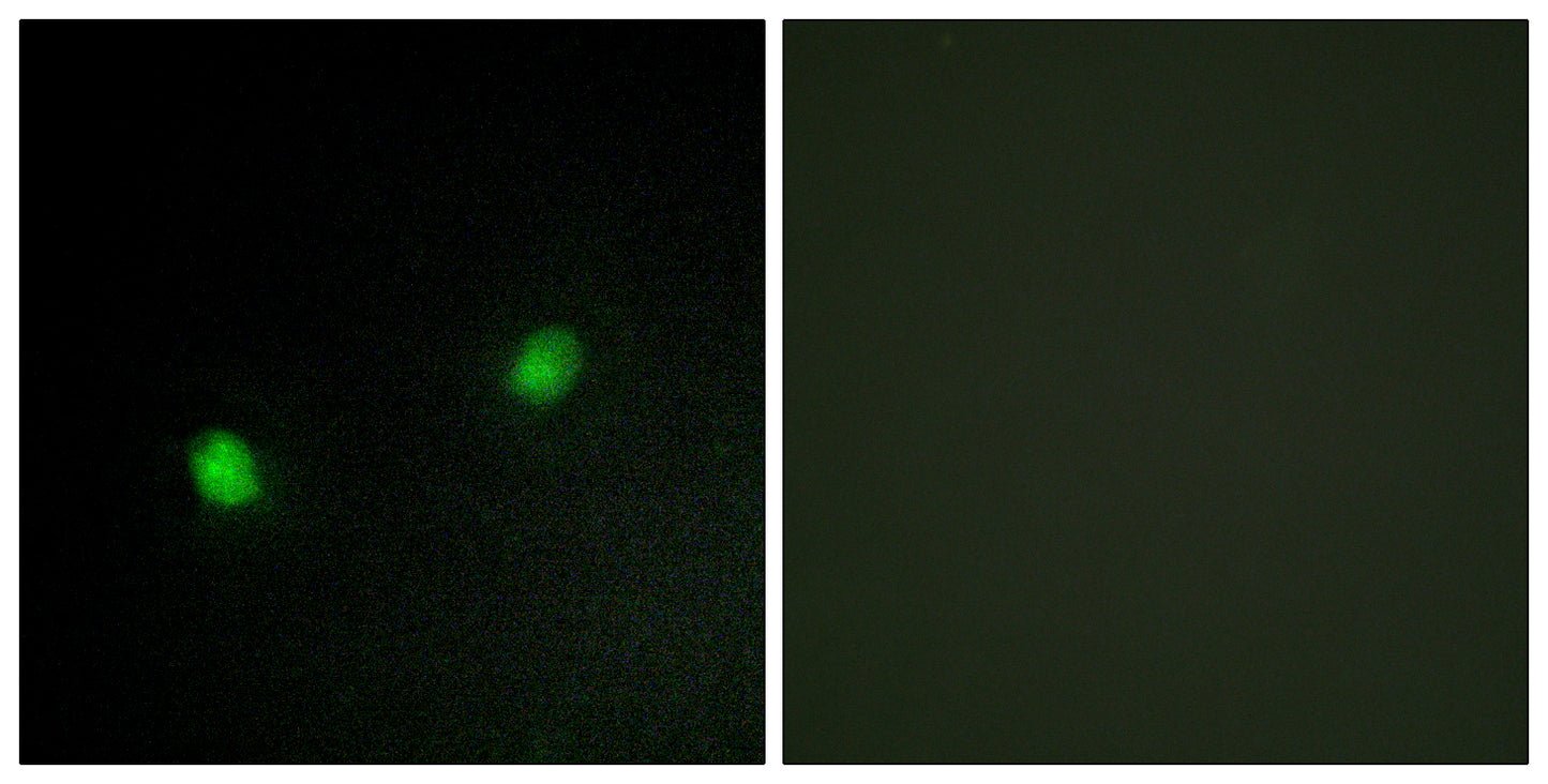 KOX4 Rabbit Polyclonal Antibody