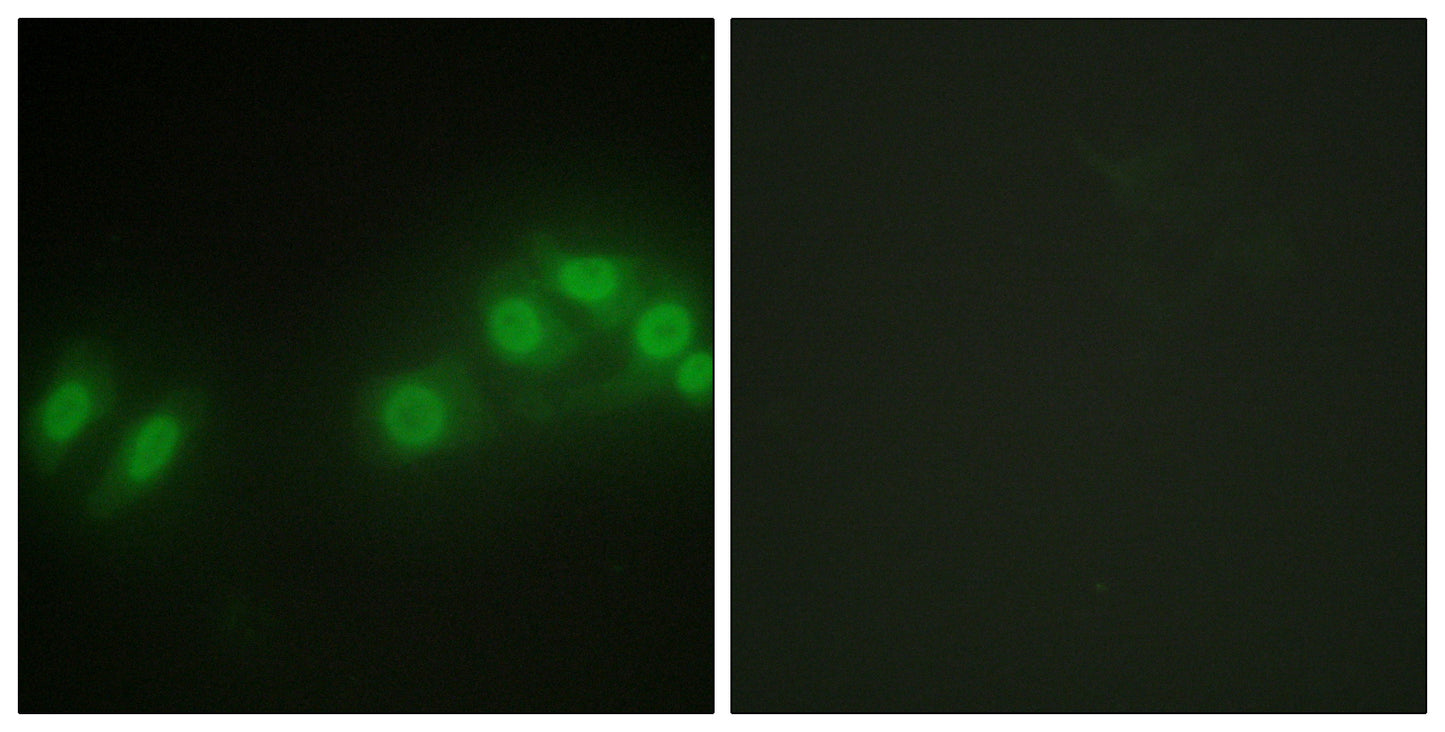 Kpm Rabbit Polyclonal Antibody