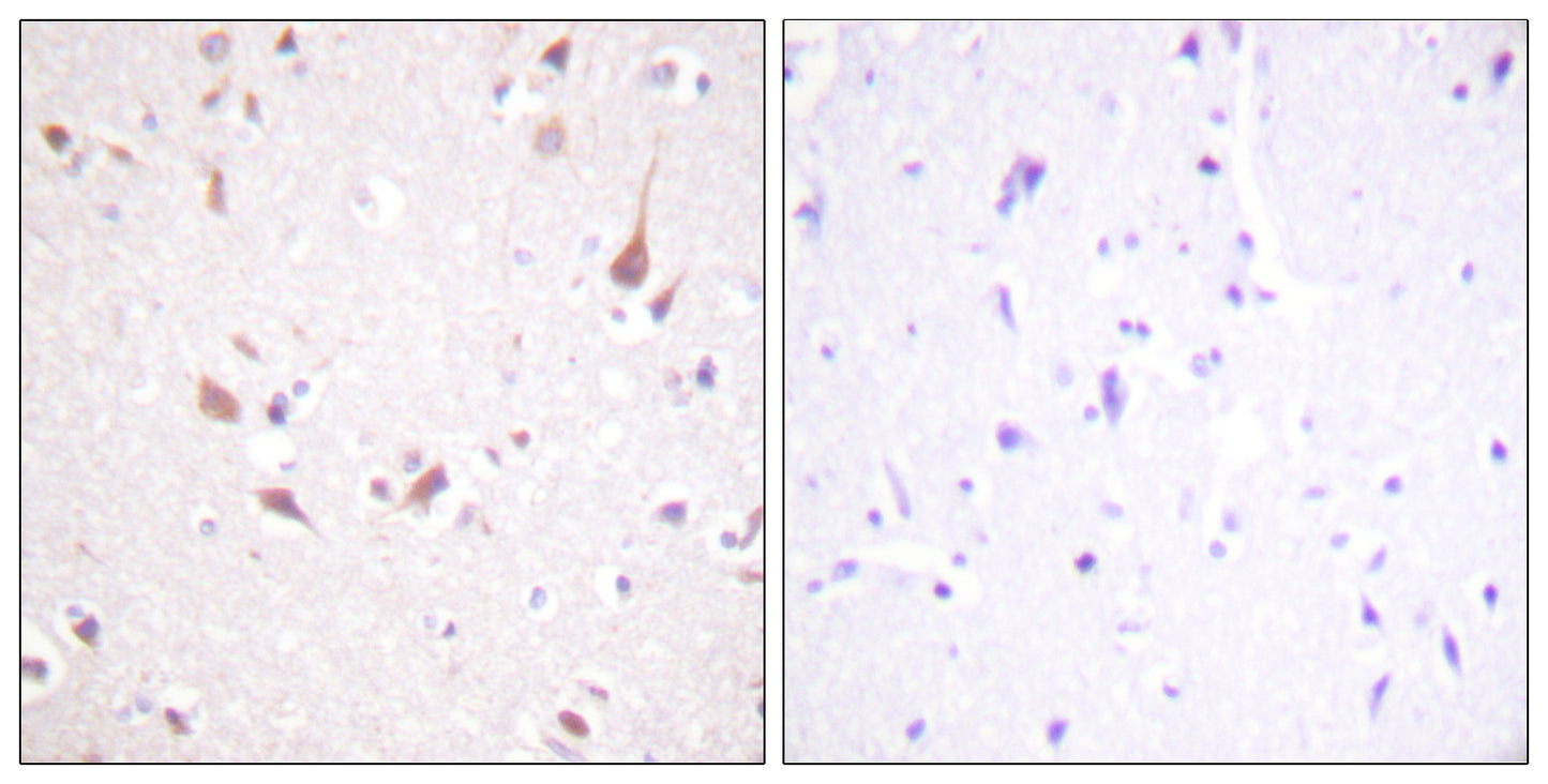 Krs-1/2 Rabbit Polyclonal Antibody