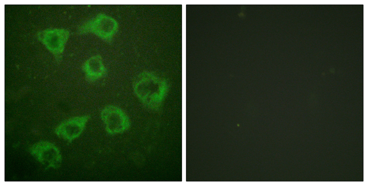 Ksr-1 Rabbit Polyclonal Antibody