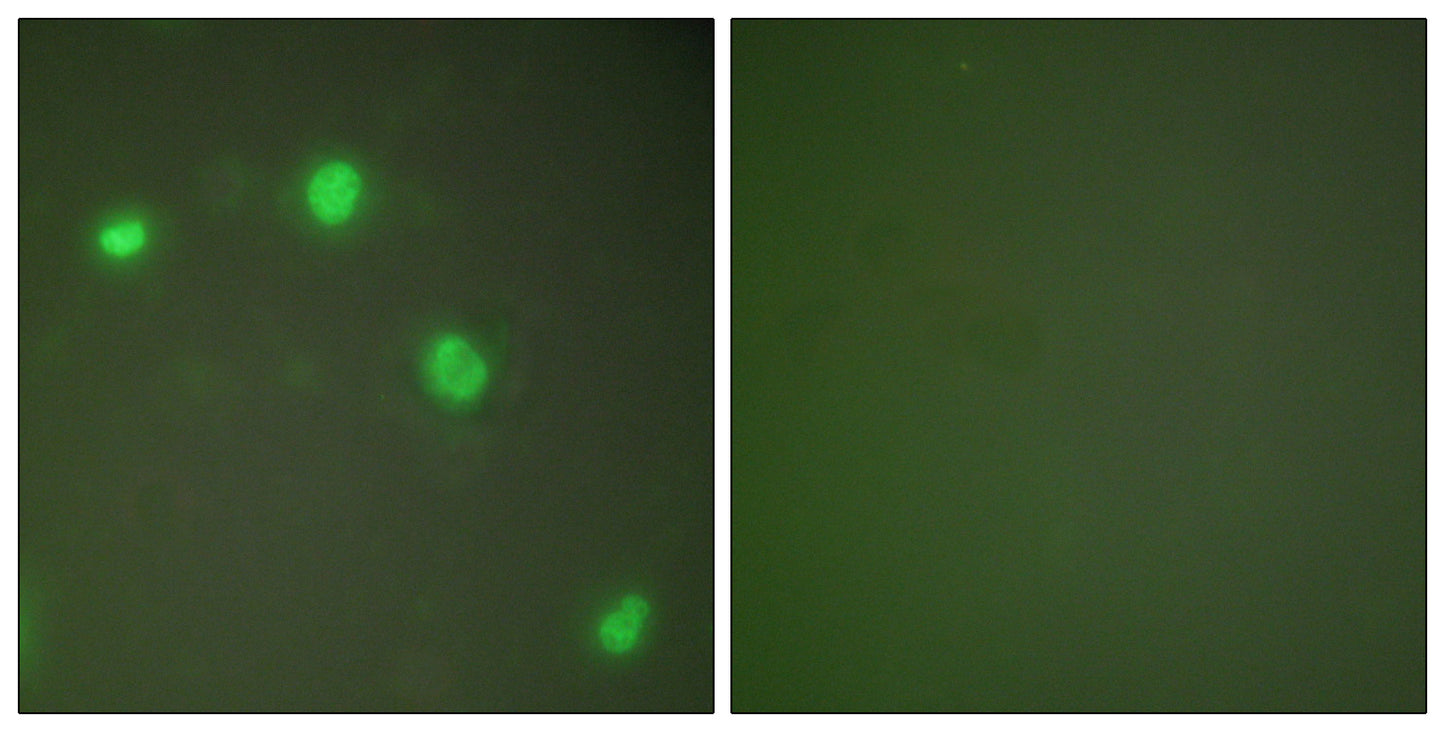 Ku-70 Rabbit Polyclonal Antibody