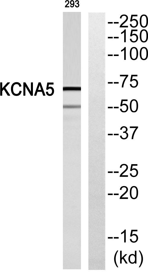 KV1.5 Rabbit Polyclonal Antibody
