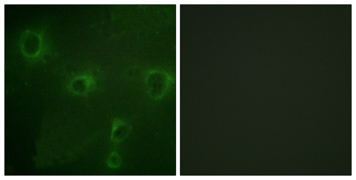 Kv2.1 Rabbit Polyclonal Antibody
