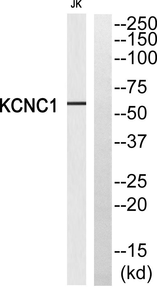 KV3.1 Rabbit Polyclonal Antibody