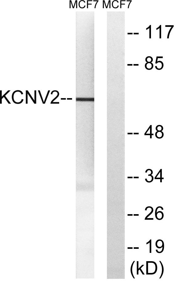 KV8.2 Rabbit Polyclonal Antibody