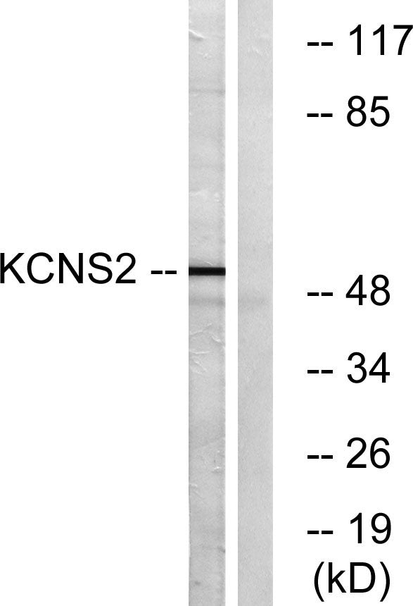 KV9.2 Rabbit Polyclonal Antibody