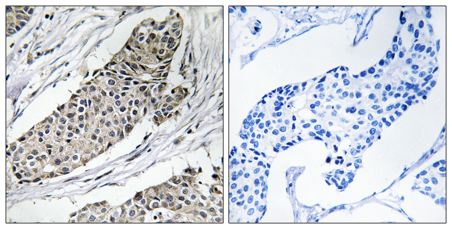 KVβ.3 Rabbit Polyclonal Antibody