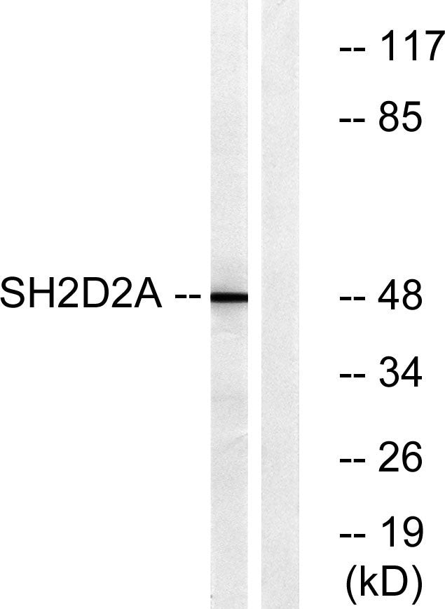 Lad Rabbit Polyclonal Antibody