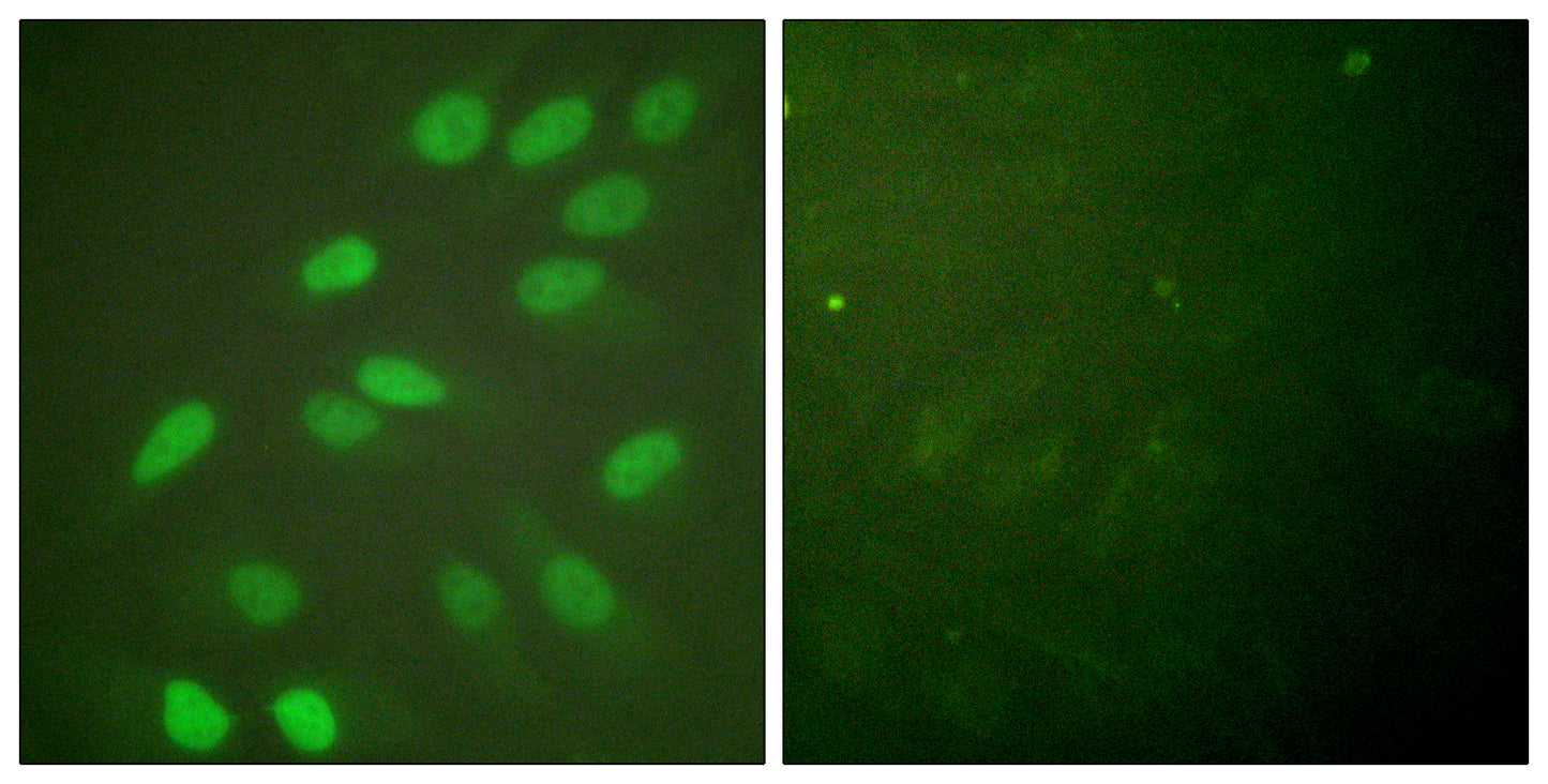 Lamin A/C Rabbit Polyclonal Antibody
