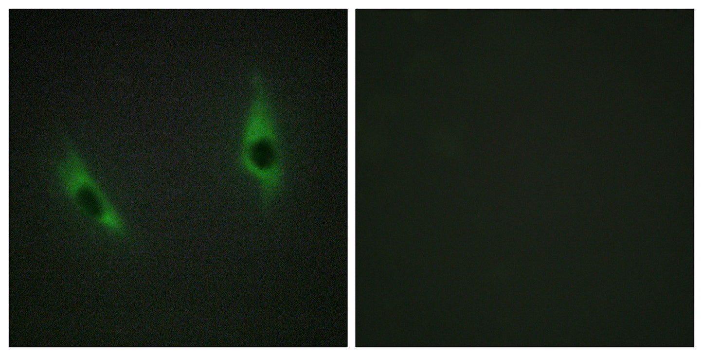 Laminin β-3 Rabbit Polyclonal Antibody
