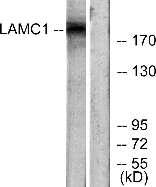 Laminin γ-1 Rabbit Polyclonal Antibody