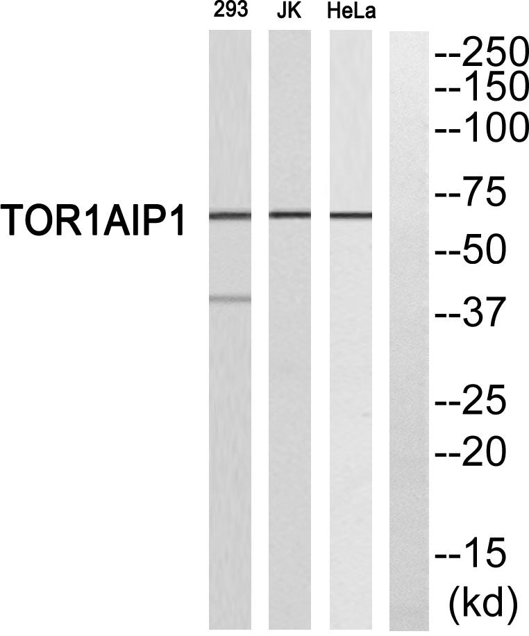 LAP1B Rabbit Polyclonal Antibody