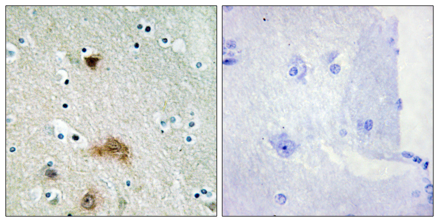 LASS4 Rabbit Polyclonal Antibody