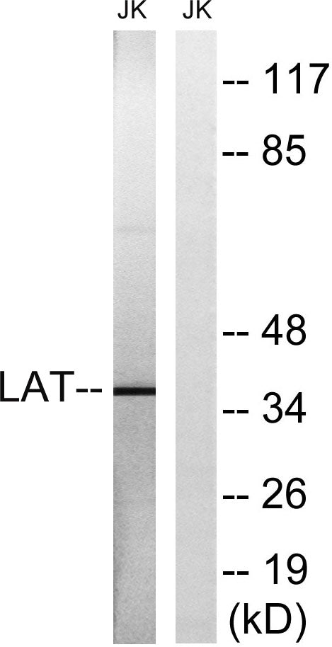 LAT Rabbit Polyclonal Antibody