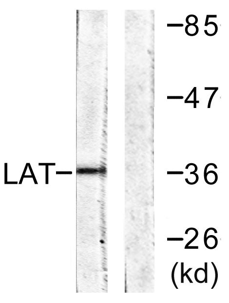 LAT Rabbit Polyclonal Antibody