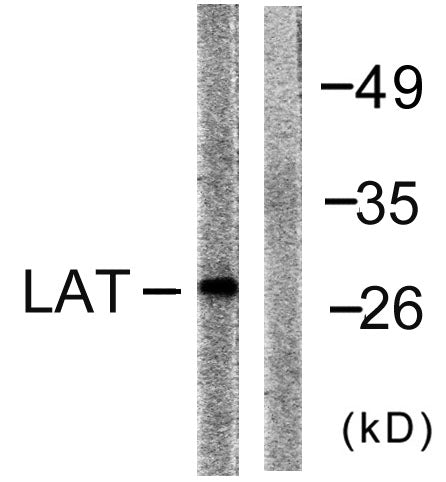 LAT Rabbit Polyclonal Antibody