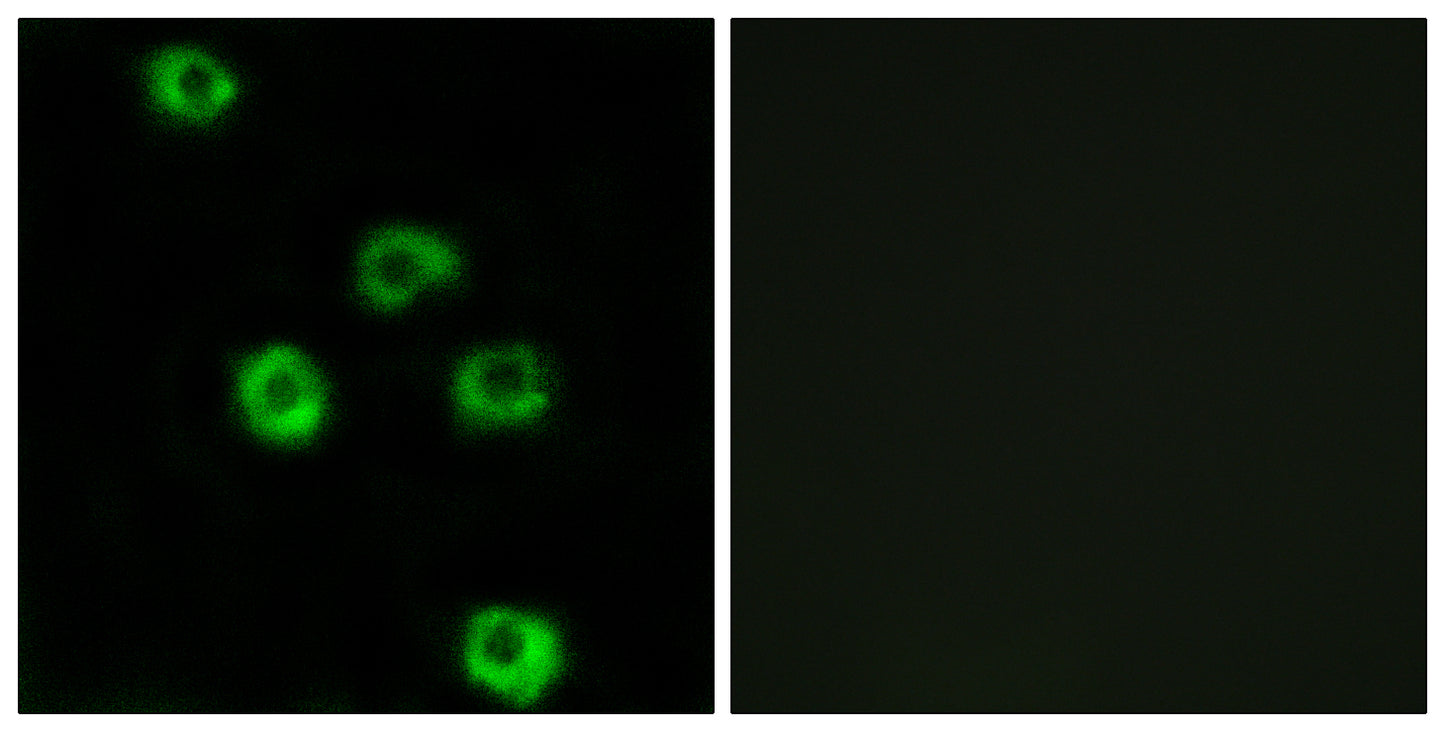 Latrophilin-2 Rabbit Polyclonal Antibody