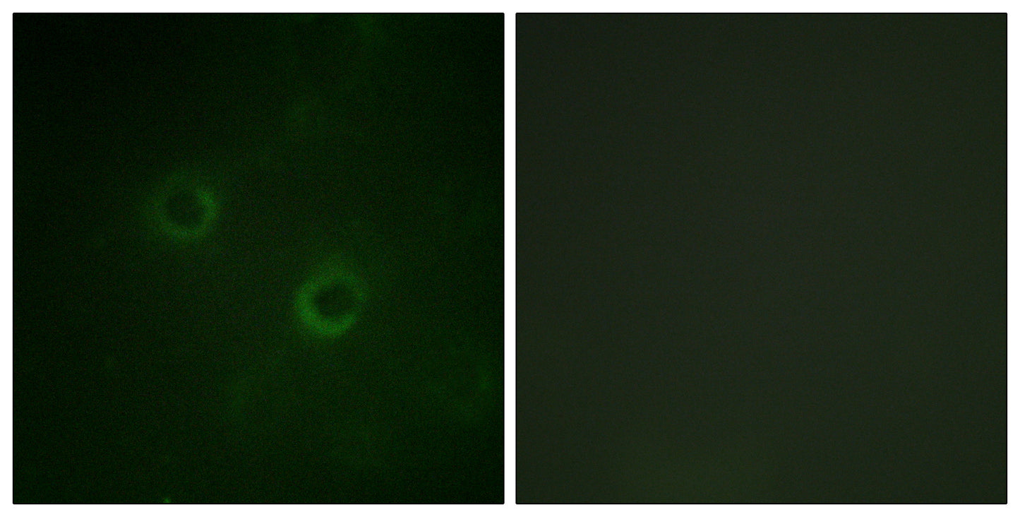 Lck Rabbit Polyclonal Antibody