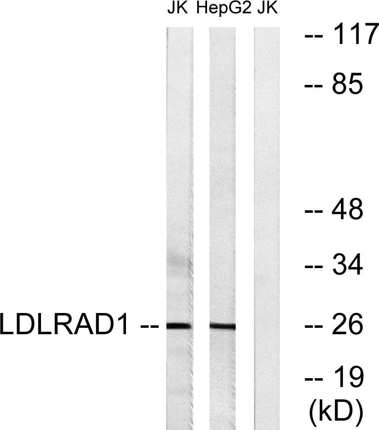 LDLRAD1 Rabbit Polyclonal Antibody