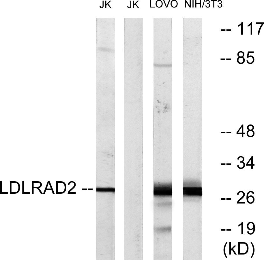 LDLRAD2 Rabbit Polyclonal Antibody
