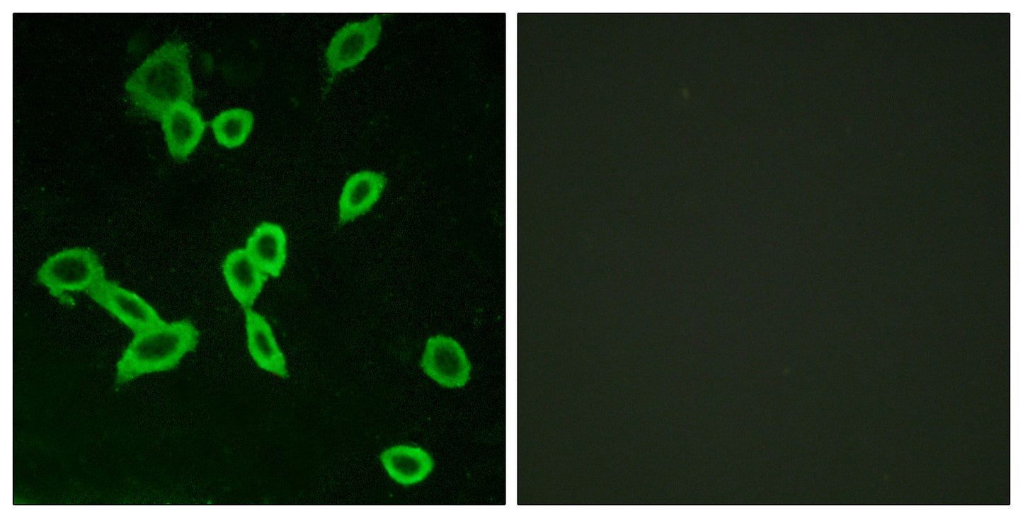 LGR6 Rabbit Polyclonal Antibody