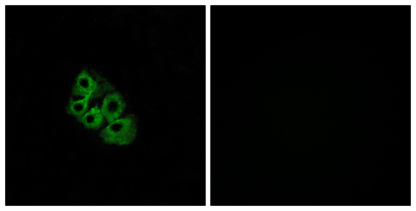 LHR Rabbit Polyclonal Antibody