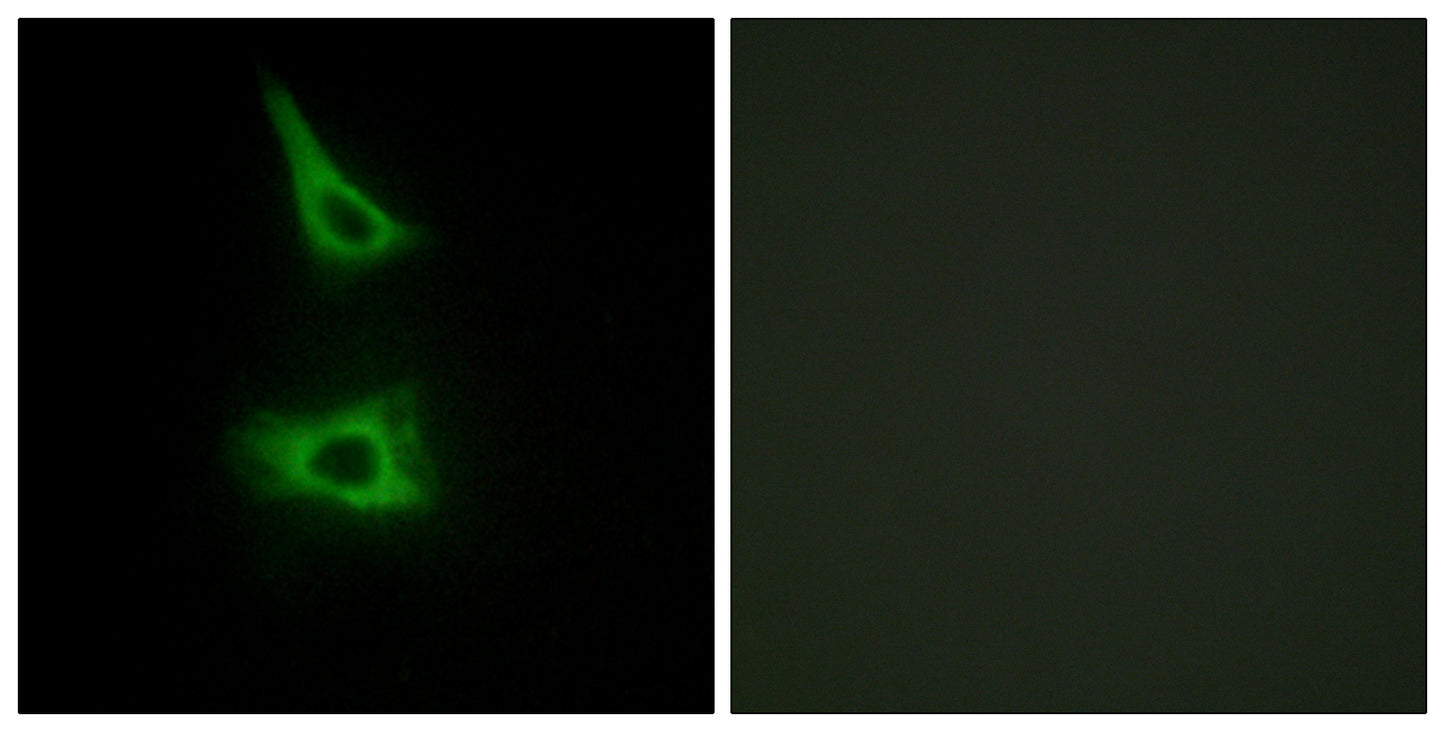 LI-cadherin Rabbit Polyclonal Antibody