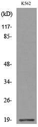 Lipocalin-1 Rabbit Polyclonal Antibody