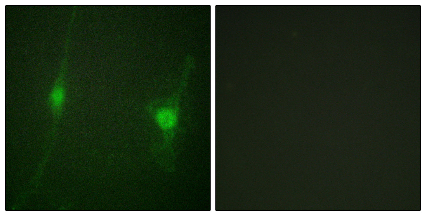 LKB1 Rabbit Polyclonal Antibody