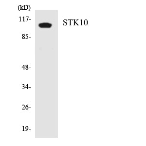 LOK Rabbit Polyclonal Antibody