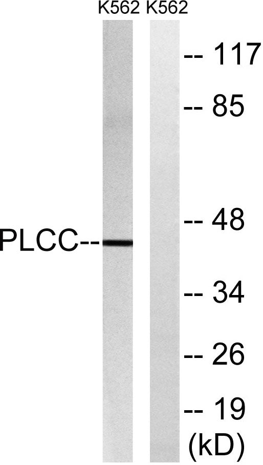 LPAAT-γ Rabbit Polyclonal Antibody