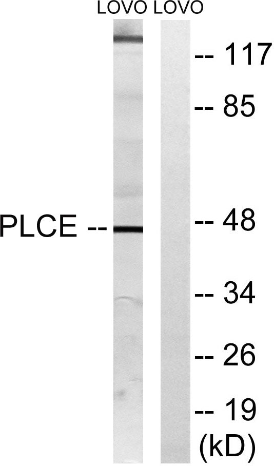 LPAAT-ε Rabbit Polyclonal Antibody