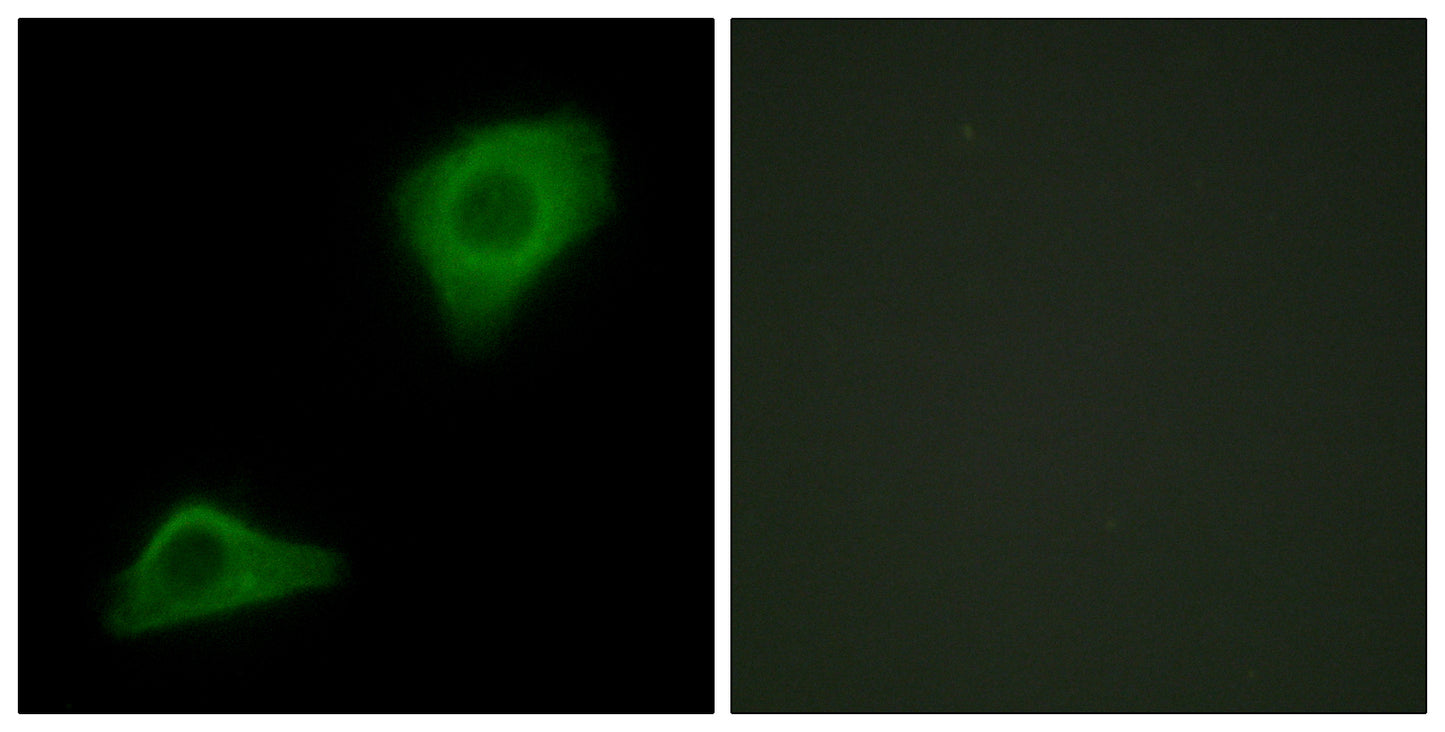 LPAAT-θ Rabbit Polyclonal Antibody