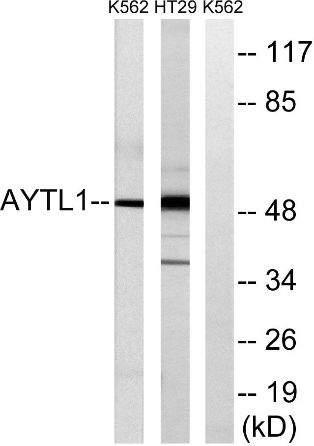 LPCAT2 Rabbit Polyclonal Antibody