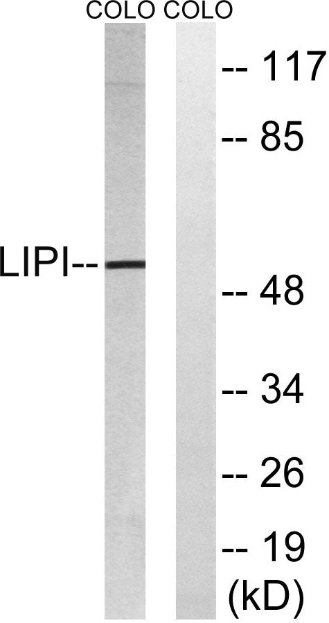 LPD lipase Rabbit Polyclonal Antibody