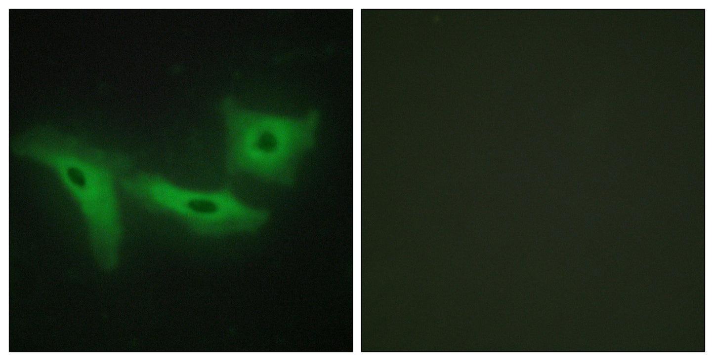 LRRK1 Rabbit Polyclonal Antibody