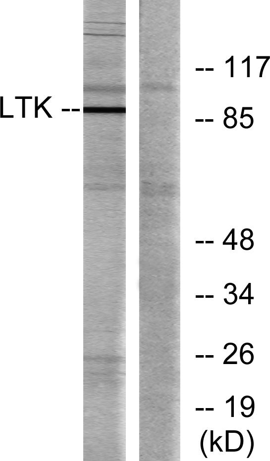 LTK Rabbit Polyclonal Antibody
